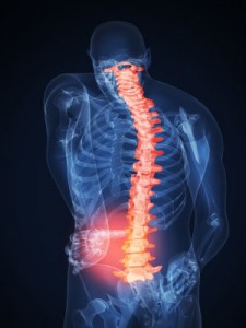 Lower back painBack pain is not a diagnosis