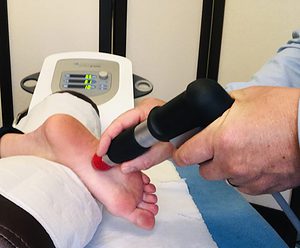Shockwave therapy on foot plantar fasciitis